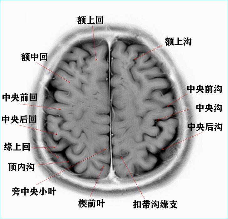 头颅分层的解剖图图片