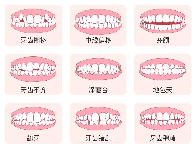 牙齿的种类有哪些图片