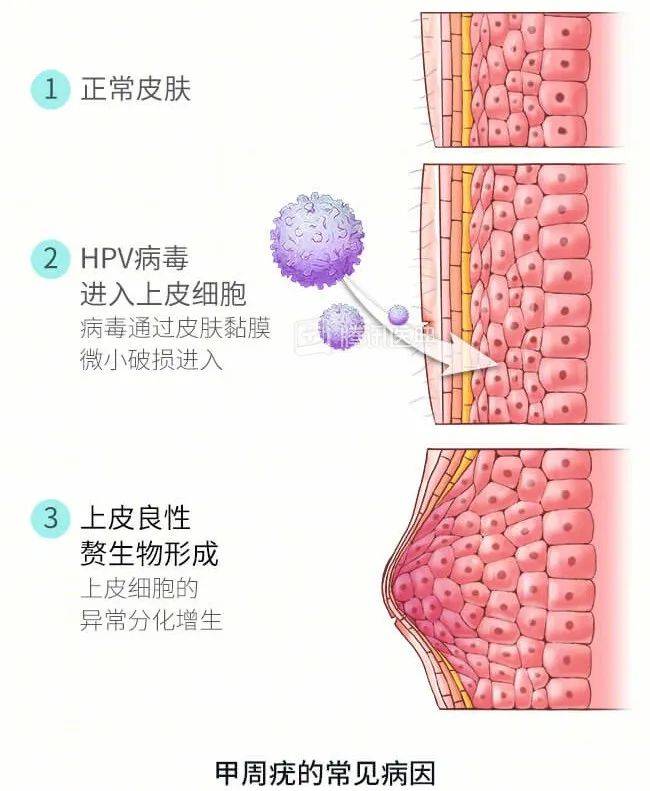 朊病毒在人体分布图片