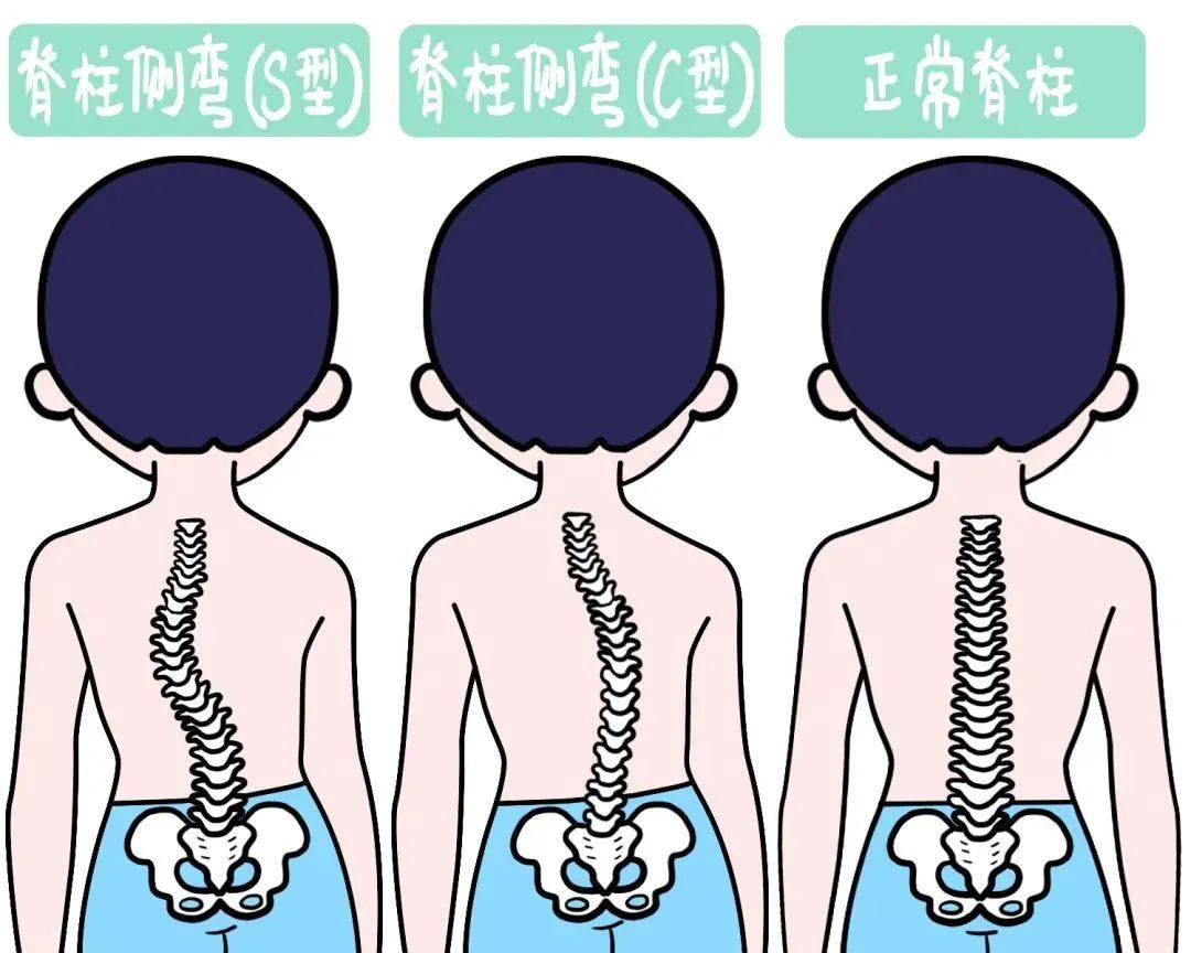 儿童的后背脊骨图图片