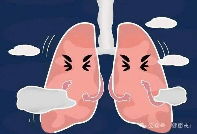痰是肺的“报警器”?白痰、绿痰、黄痰、黑痰,分别代表了什么?_呼吸道_肺部_症状