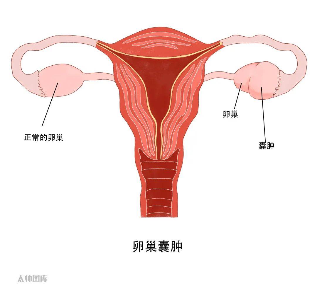 子宫附件盆腔图片