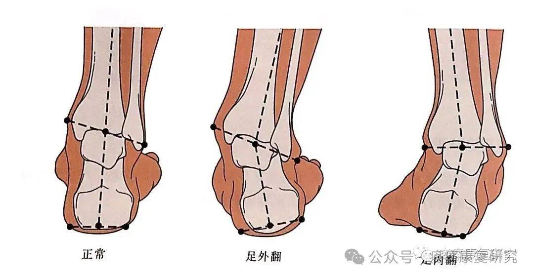 足踝生物力学6s中心图片