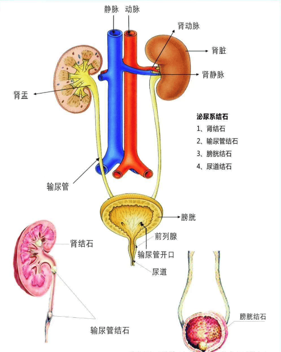 女性输尿管走形图片图片