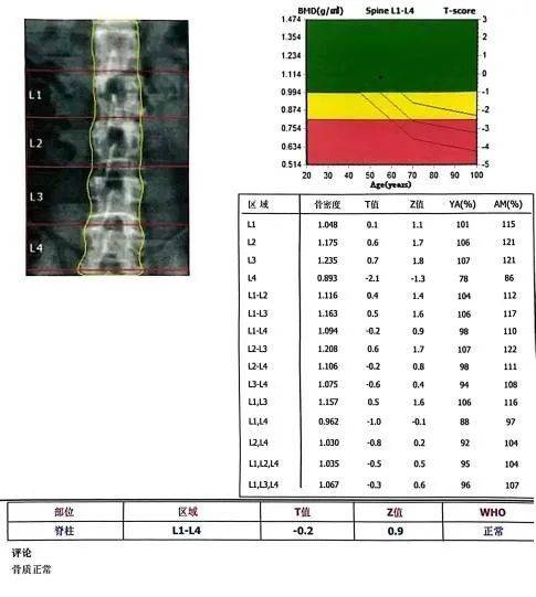 骨密度曲线图图片图片