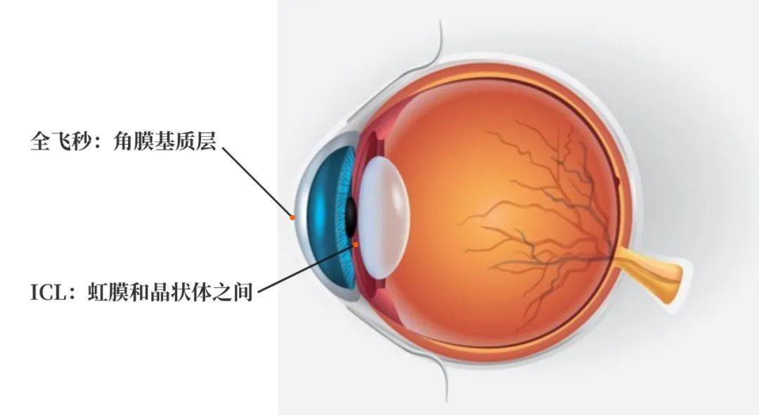 眼睛_晶状体_角膜