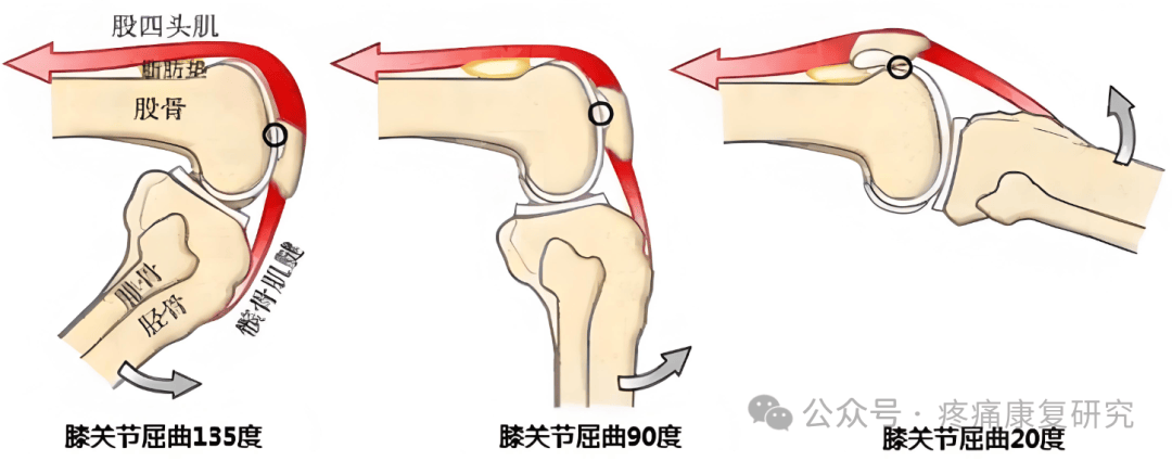 膝关节屈曲示意图图片