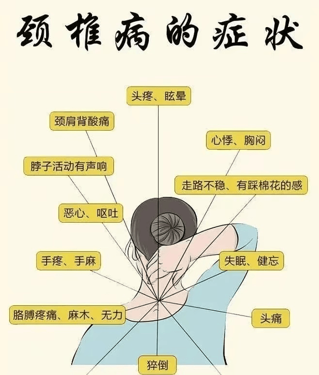 颈椎病的症状表现图片