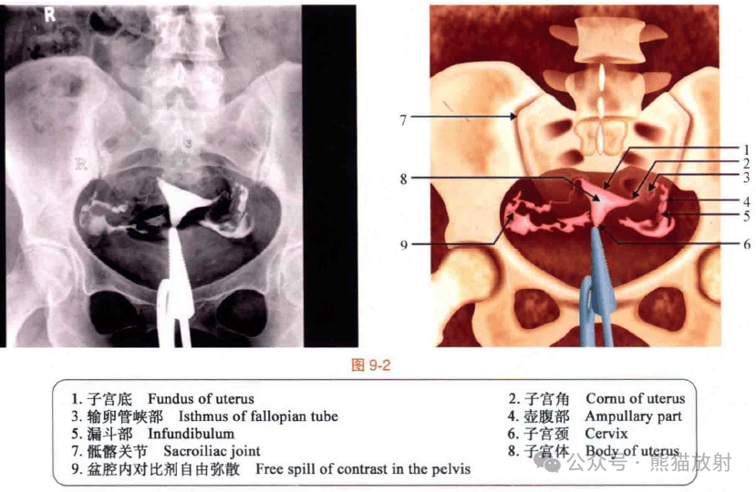 影像解剖丨盆腔