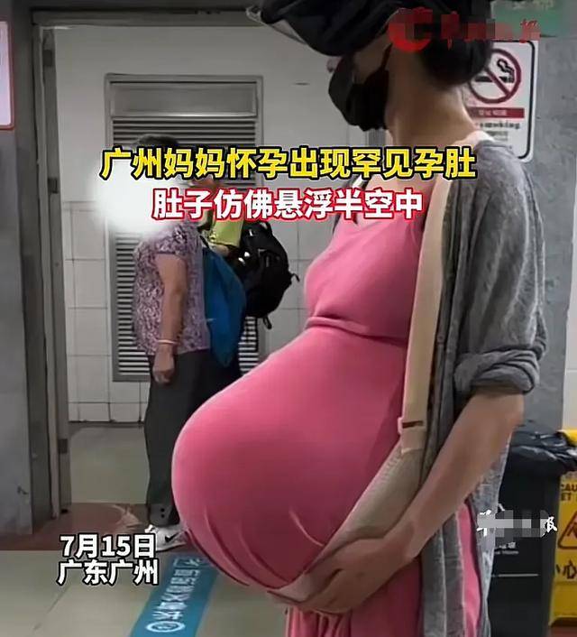 纵隔子宫怀孕歪肚子图图片