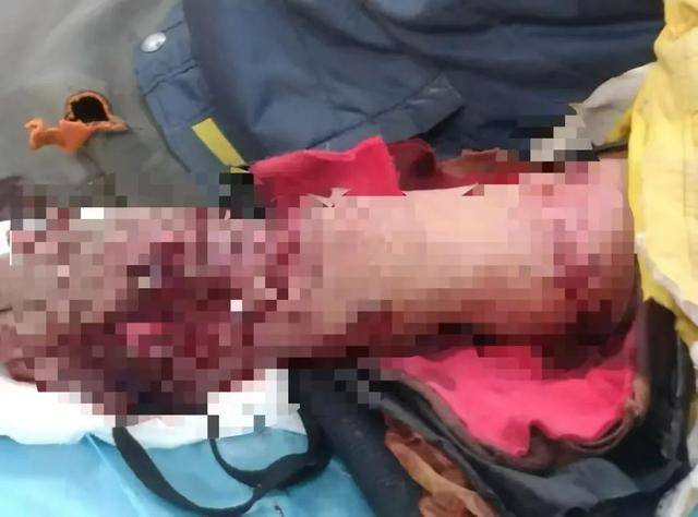 官方通报野生东北虎闯入村落致一村民受伤：正对老虎进行追踪