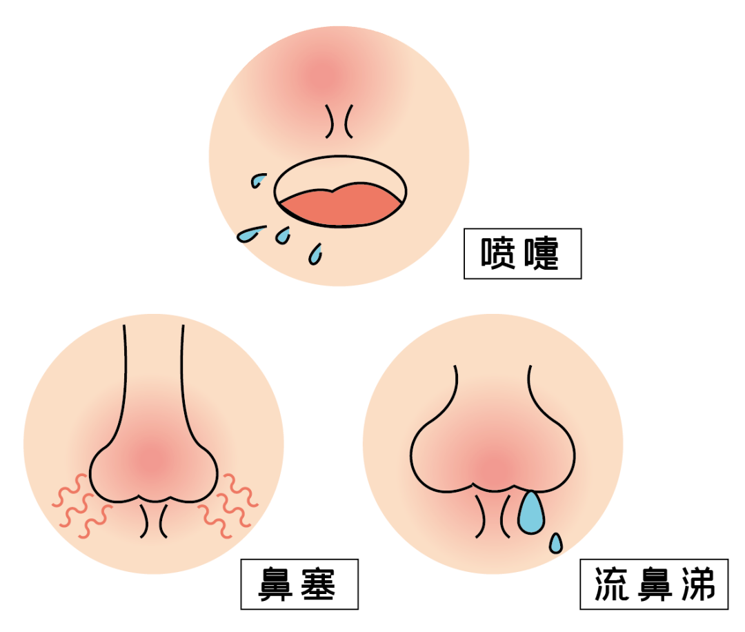 鼻粘膜水肿怎才能消除图片