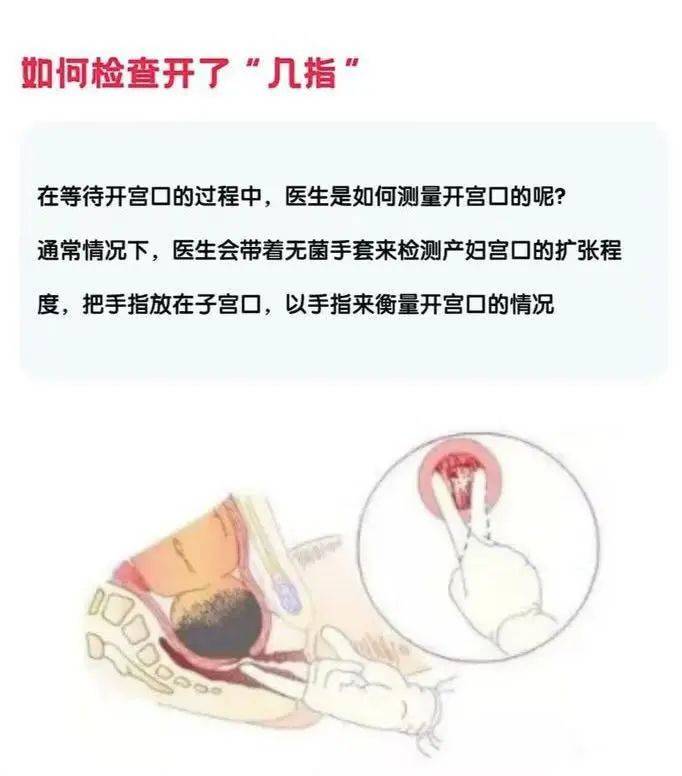 宫口开十指图片图片