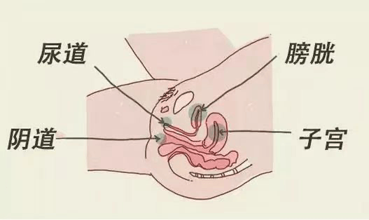 因为女性尿道短而直,位置靠近阴道和肛门,容易受到阴道分泌物和粪便的