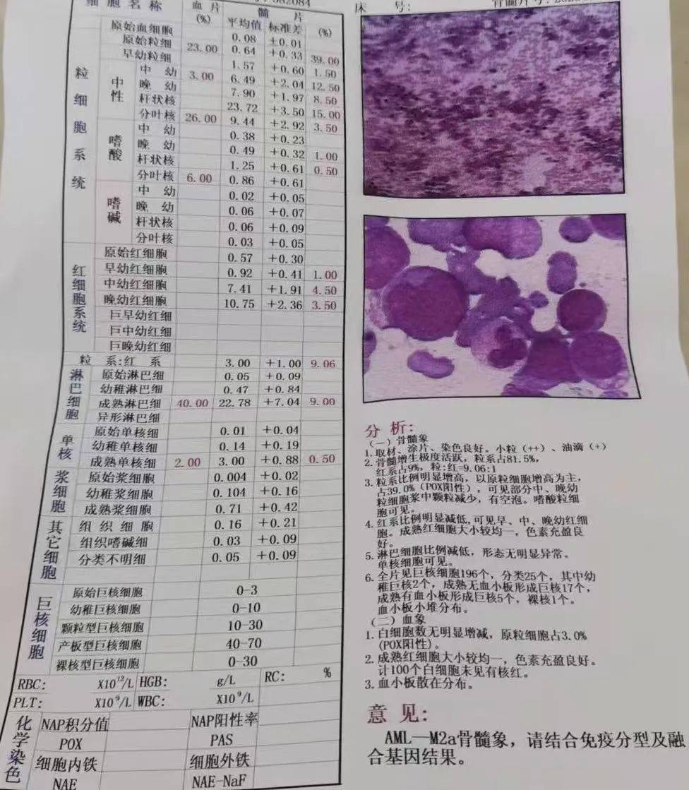 她考虑扬扬的反复肛瘘可能与免疫功能低下有关