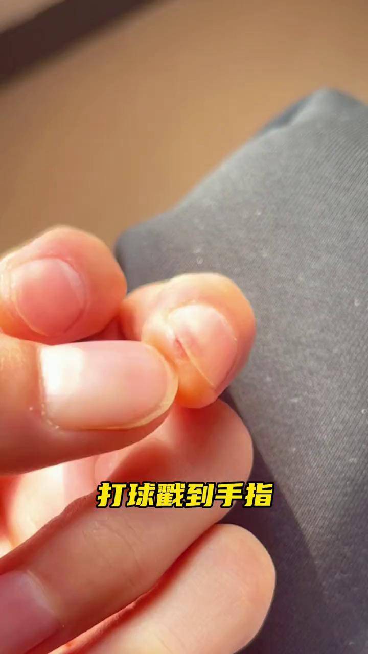 玩胶带球手烂图片