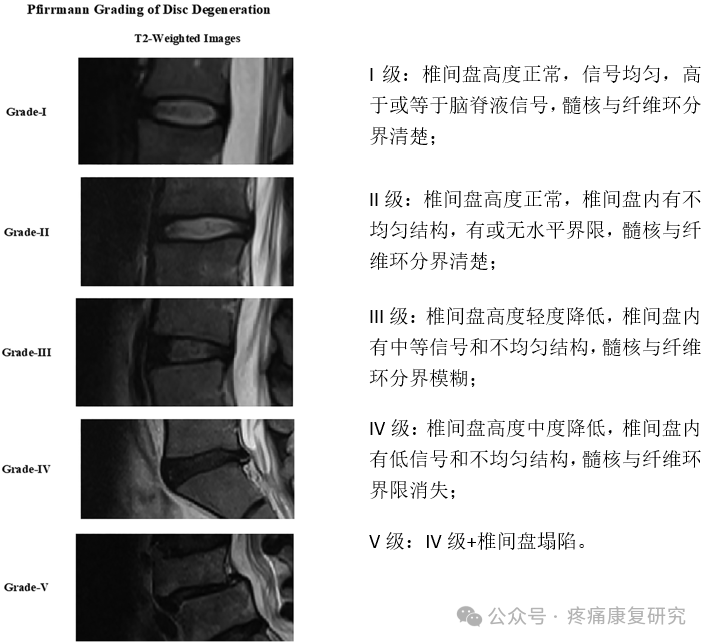 腰痛:椎体终板炎的解剖、分型及MRI表现_Modic_椎间盘_信号特征