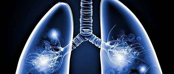 机化性肺炎的综合多组学分析_代谢_研究_疾病