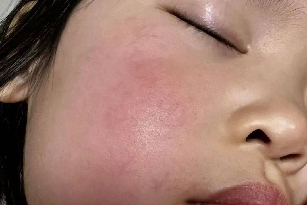 脸为什么会红
