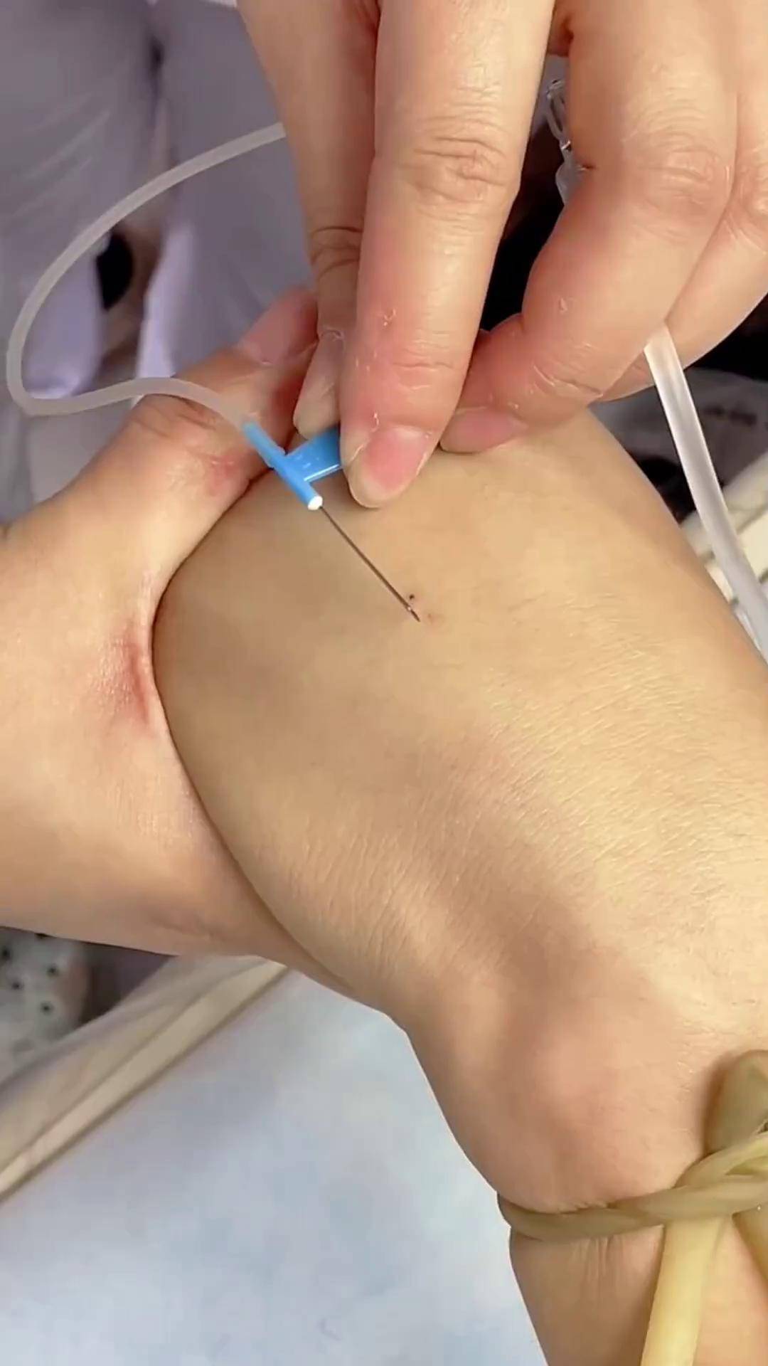 分享日常扎针 "门诊护士工作日常 "是时候露一手了 "干的是技术活更是