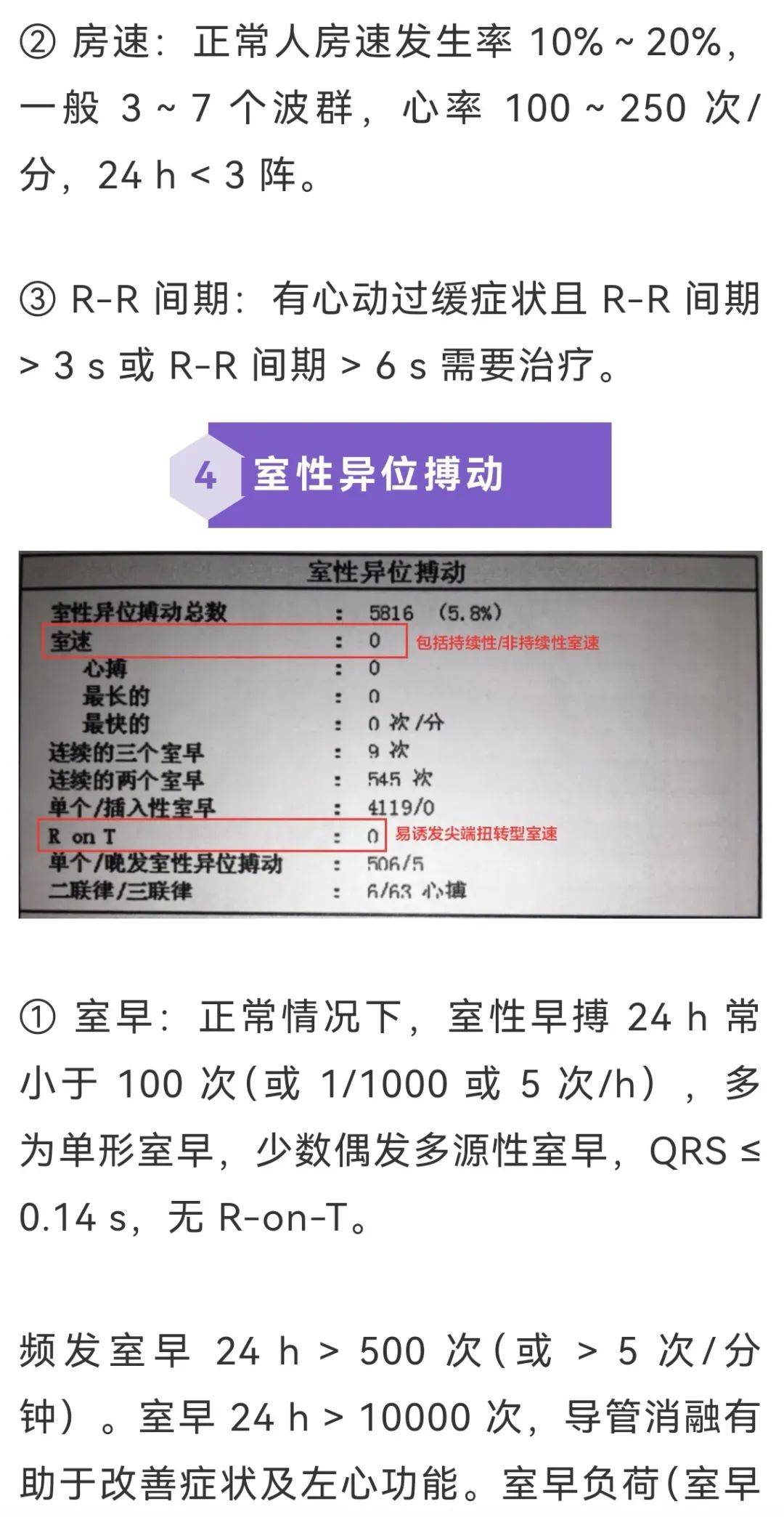 24小时心电图指标解读图片