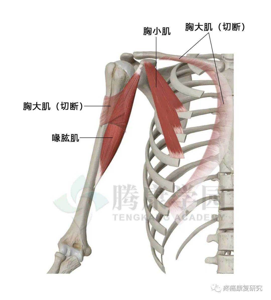 肩胛提肌扳机点图片