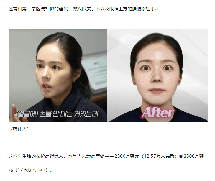 当年韩国人照着她整容,现在她自己想整了,然而效果.网友:不如不整!