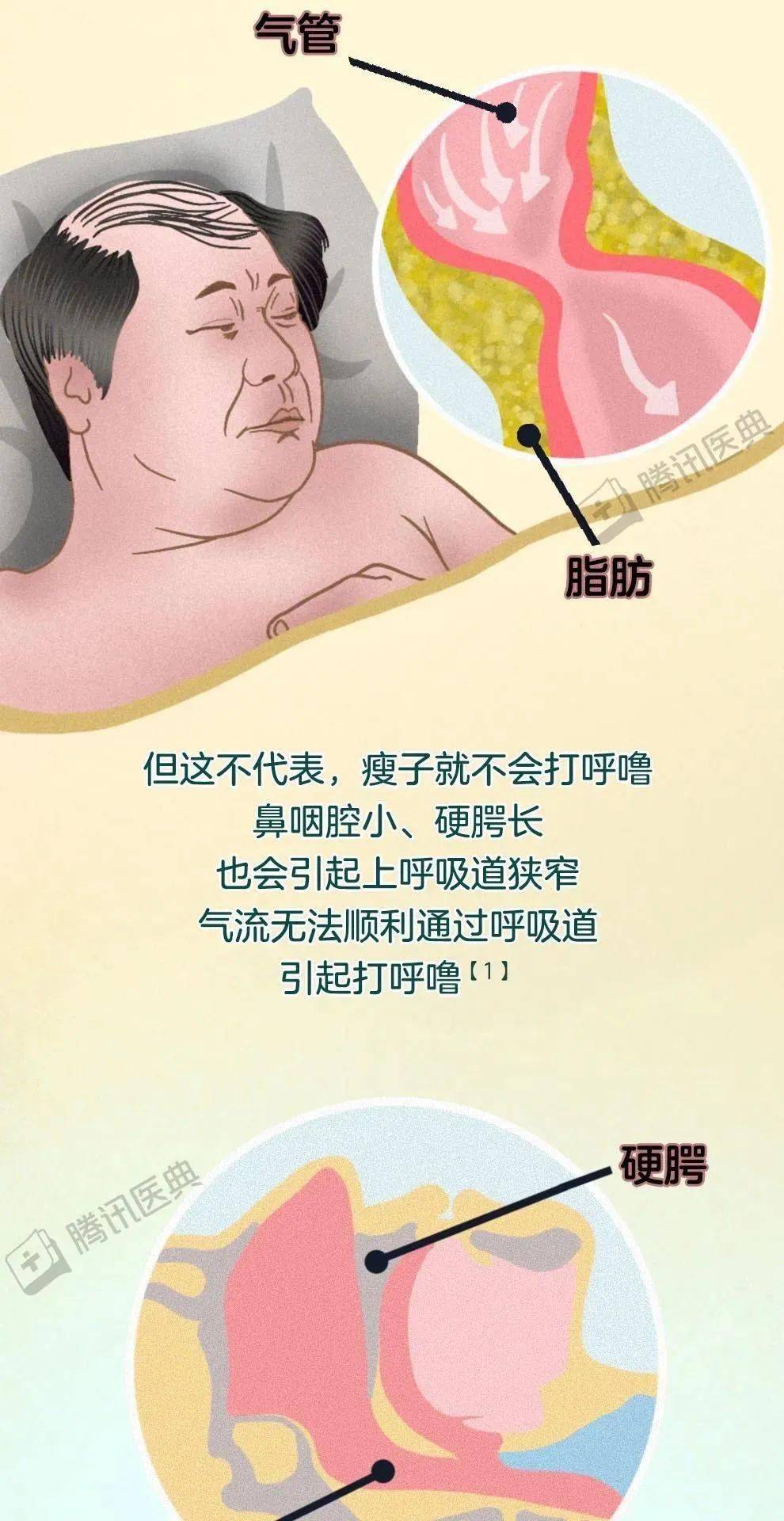 为什么最近突然打呼噜了为什么在线