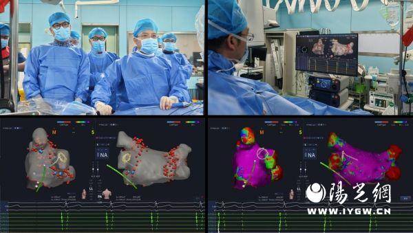 惠泰医疗PFA技术获批后三维脉冲消融解决方案市场空间分析