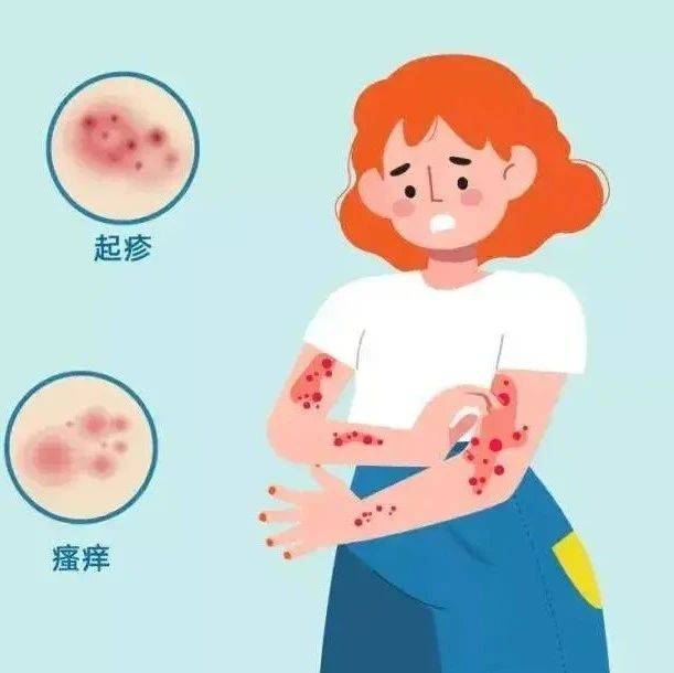 痒痒痒!春季突然起疹子是怎么回事?_皮肤_花粉_tips