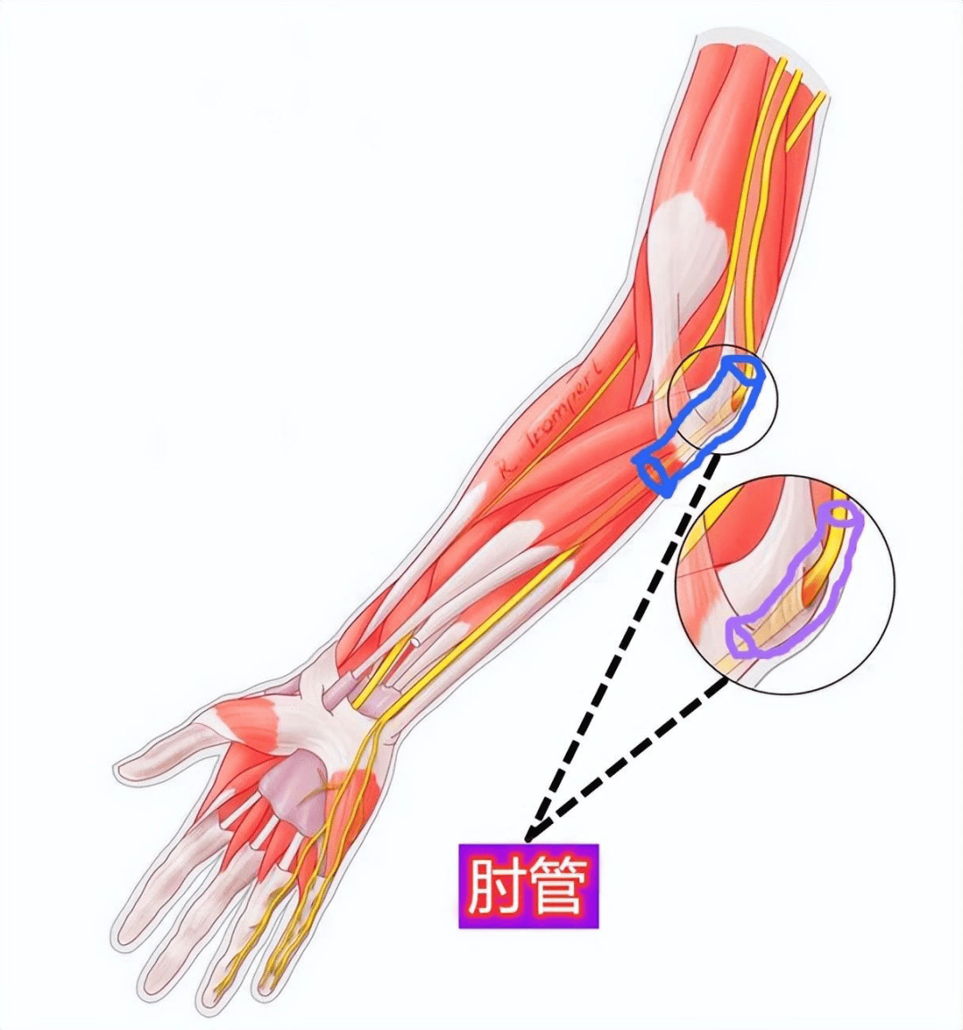 手麻不只是压着了!可能是身体在求救!