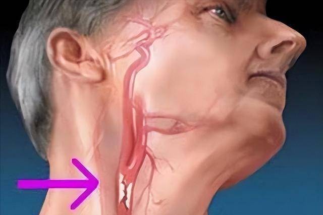 惊！黑眼圈竟藏着这么多健康秘密，别小瞧黑眼圈，它可能是身体的求救信号