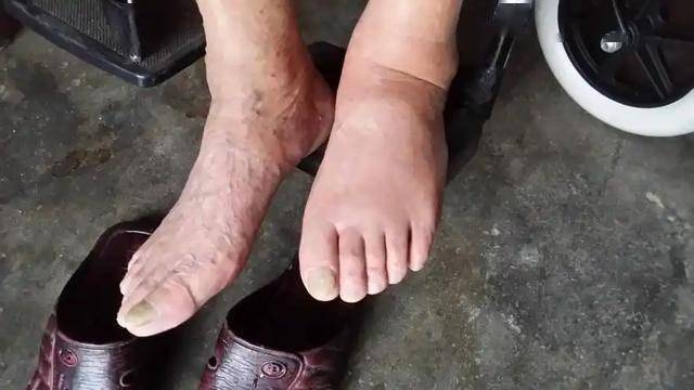 跳出“吃”的误区，探寻尿酸高的真正根源！，别只怪吃啦，尿酸高的深层原因大揭秘！