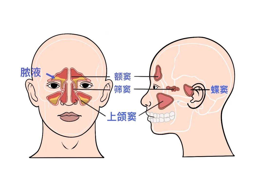 左右共有四对:上颌窦,筛窦,额窦及蝶窦