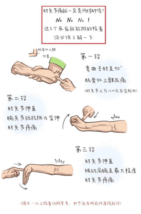 肘关节疼痛,可能是"网球肘"所致