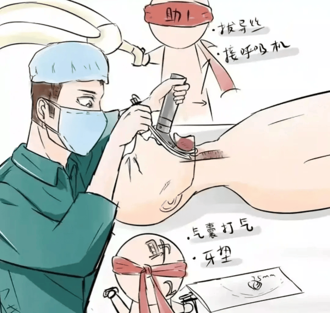 家属必知的气管插管真相!