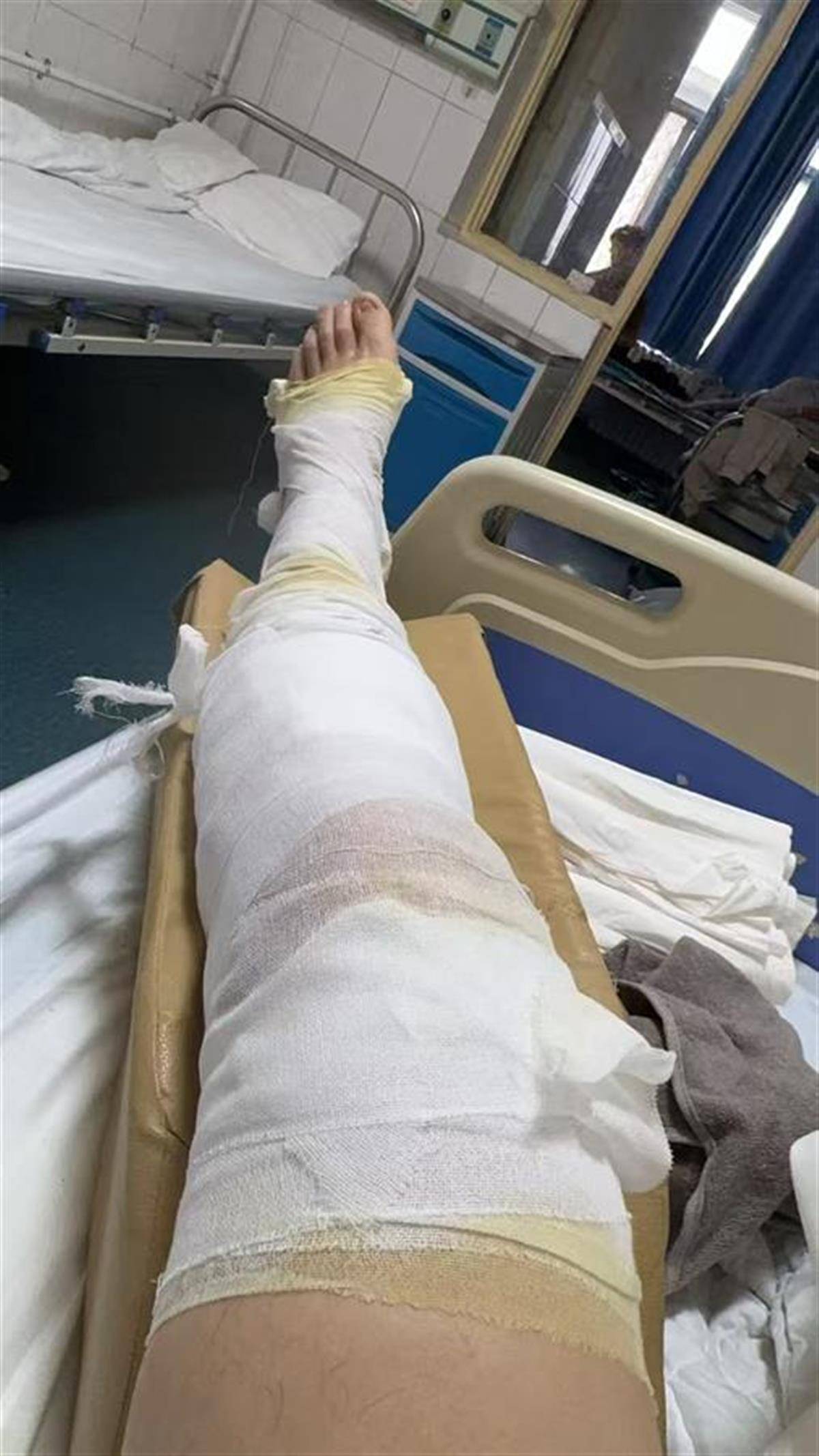 男子五一到南阳玩卡丁车致腿部骨折,当事人称景区暂未垫付医疗费用