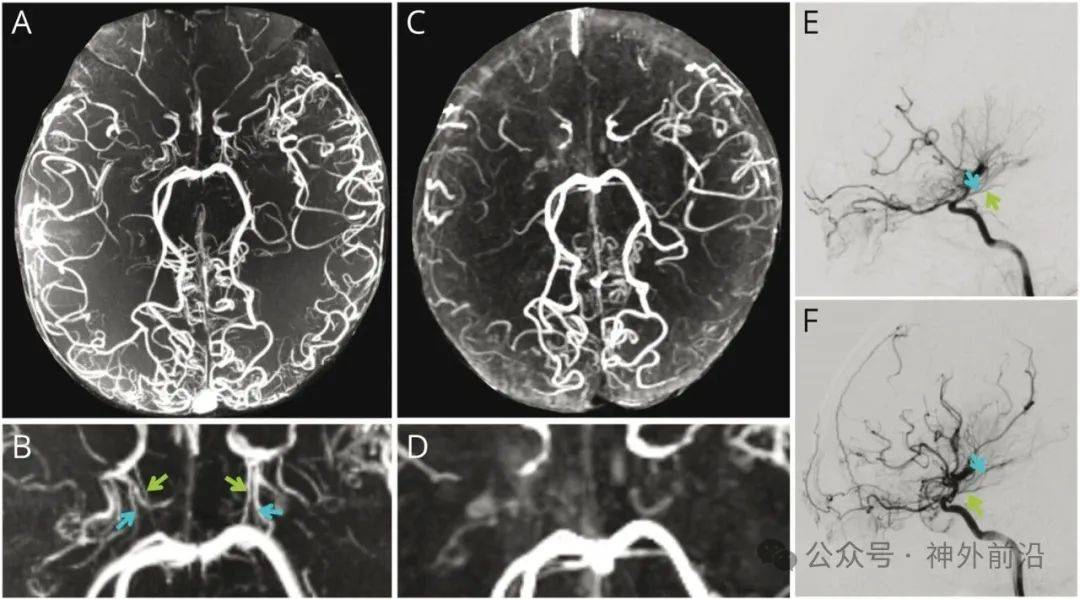 天坛医院核磁加急-天坛医院新院核磁共振网上预约 