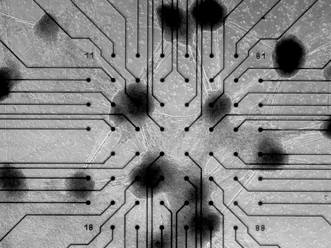 20 万一台的「人脑计算机」，可能是人类战胜 AI 的唯一方式？