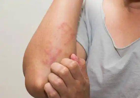  疫情发生的症状表现(疫情 发生)