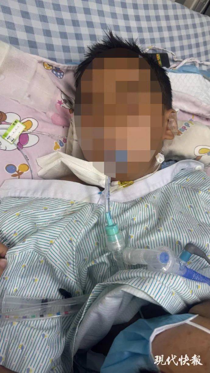湛江3岁男童扁桃体手术10天后脑死亡 当地卫健局已介入调查(图1)