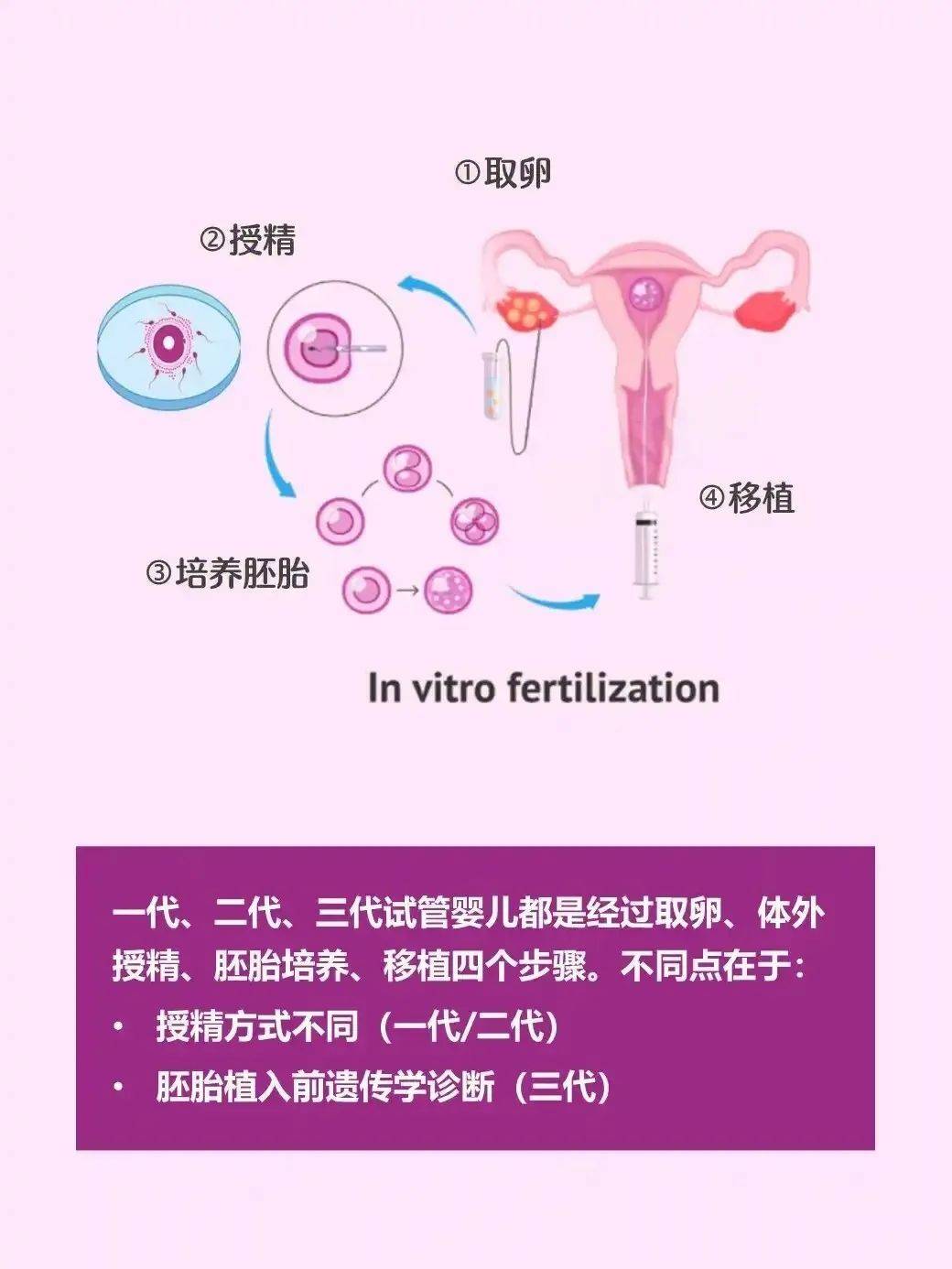 全面解析试管助孕流程