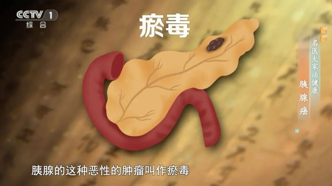 炎症是“小病”？别拖，小心发展成“癌中之王”！做好这5件事，癌细胞都怕你