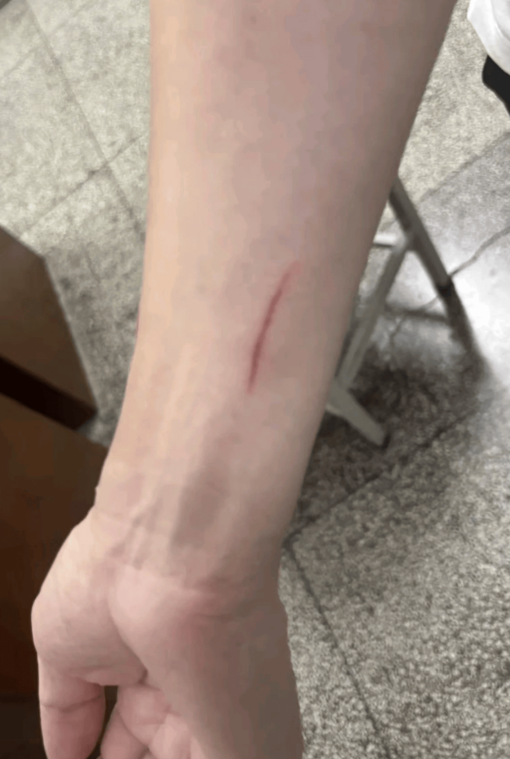 网友称丈夫被酒店养的猫抓伤，酒店回应：索赔2万元不合理，无法承担