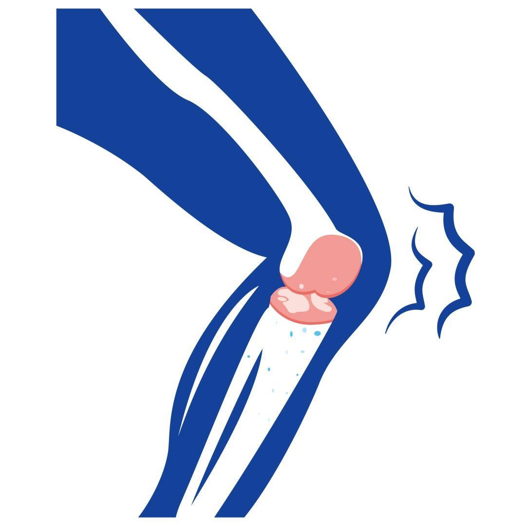 这几个加速膝盖报废的动作,你可能天天做!