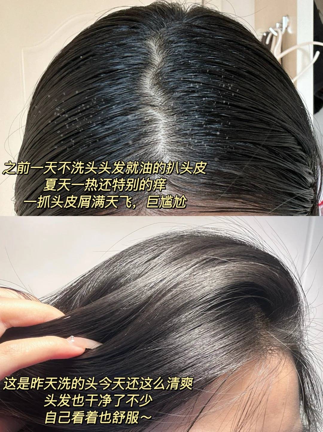 蓬松控油去屑洗发水推荐?解决女士头油头屑烦恼