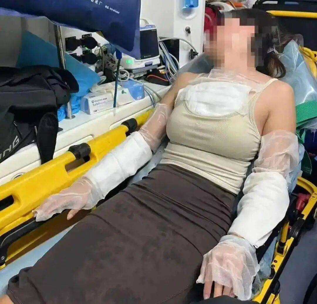 女子在日料店被烫伤，确诊中度抑郁！称“服务员又叫又哭，突然向自己泼开水”