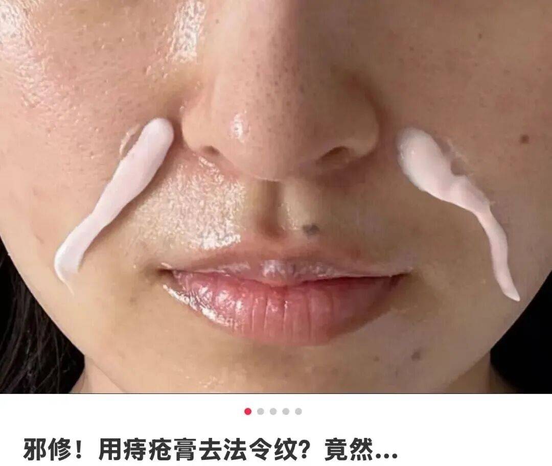 10块钱的小药膏，被年轻人用成贵妇医美