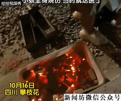 痛心！3岁男童不慎掉进炭火堆，全身85%烧伤，母亲徒手救出