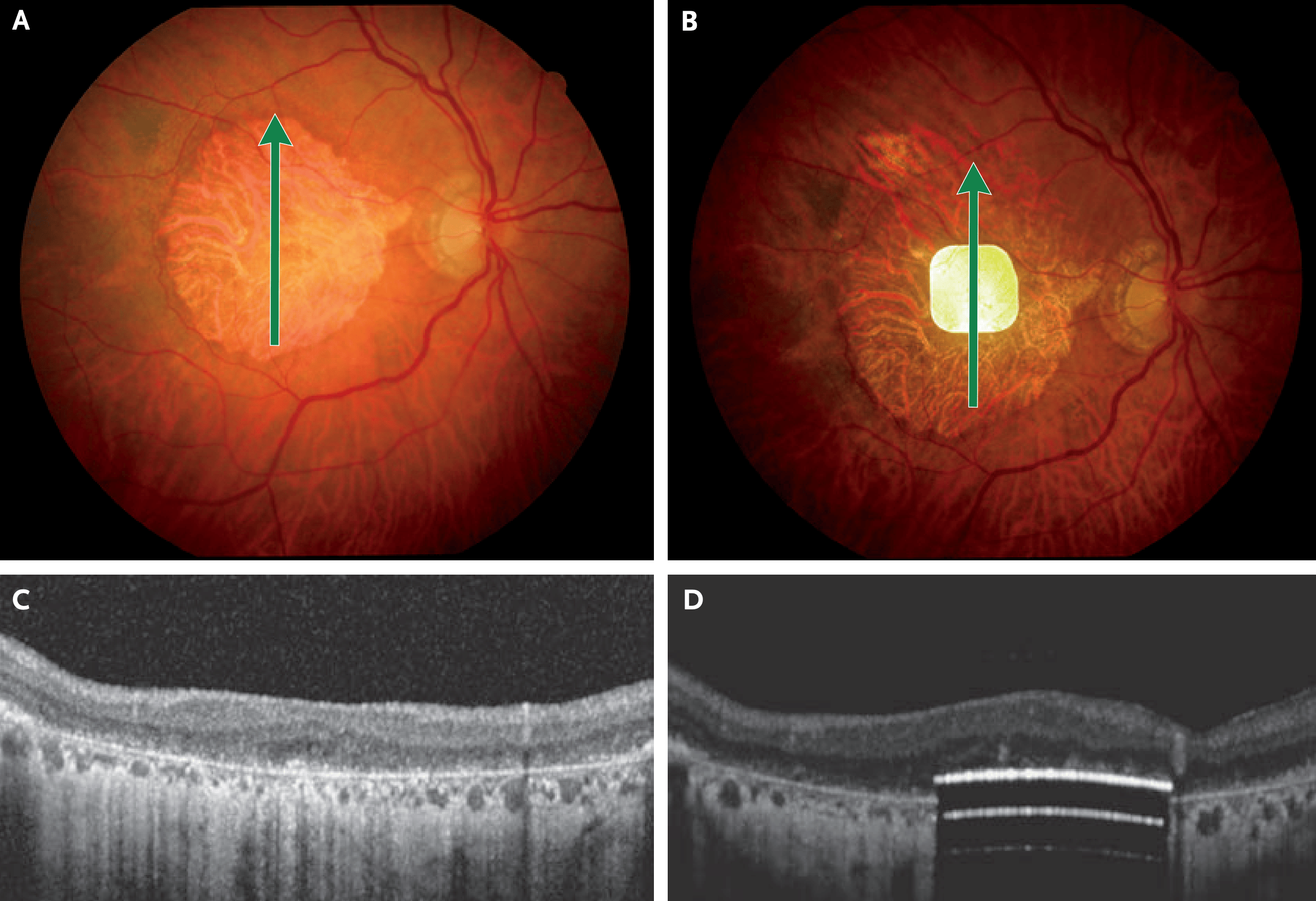 一副 AI 眼镜,让 500 万盲人有了重见光明的希望